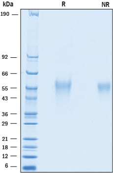 Recombinant Cynomolgus Monkey IL-18 BPa His-tag Protein SDS-PAGE