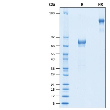 Recombinant Cynomolgus/Rhesus IL-21R Fc Chimera Protein SDS-PAGE