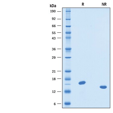 Recombinant Human IL-21 GMP Protein SDS-PAGE