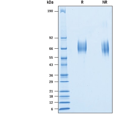 Recombinant Cynomolgus Monkey IL-23R His-tag Protein SDS-PAGE