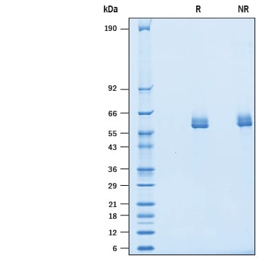 Recombinant Cynomolgus Monkey IL-27 His-tag Protein SDS-PAGE