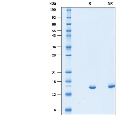 Recombinant Human IL-2 (Mammalian-expressed) Protein SDS-PAGE