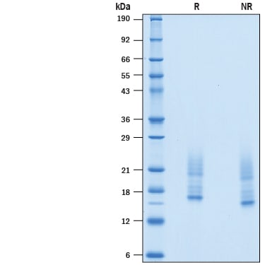 Recombinant Mouse IL-31 (Mammalian-expressed) Protein SDS-PAGE
