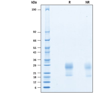 Recombinant Human IL-31 (HEK293-expressed) Protein SDS-PAGE