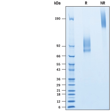Recombinant Human IL-7R alpha/CD127 Fc Avi-tag Protein SDS-PAGE