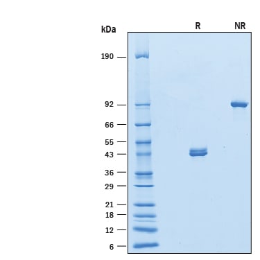 Recombinant Human ILDR1 Fc Chimera Protein SDS-PAGE