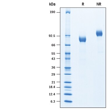Recombinant Human ITIH1 His-tag Protein SDS-PAGE