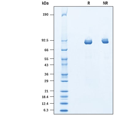 Recombinant Human ITIH3 His-tag Protein SDS-PAGE