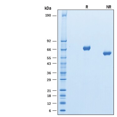 Recombinant Human Kirrel1/NEPH1 His-tag Protein SDS-PAGE