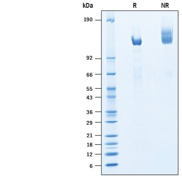 Recombinant Cynomolgus Monkey Klotho beta His Protein SDS-PAGE