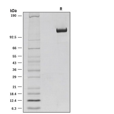 Recombinant Mouse Klotho beta Protein SDS-PAGE