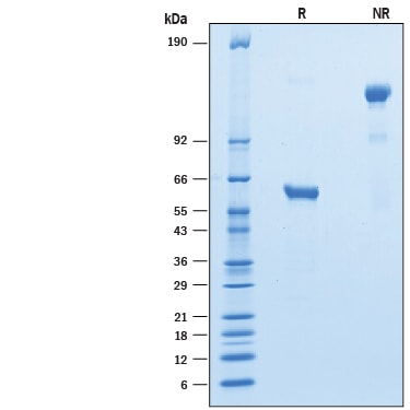 Recombinant Cynomolgus LAIR1 Fc Chimera Protein SDS-PAGE
