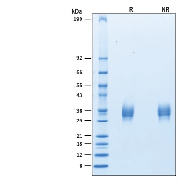Recombinant Human LAIR1 His-tag Avi-tag Protein SDS-PAGE