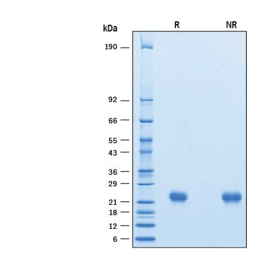 Recombinant Human LAIR2 His-tag Avi-tag Protein SDS-PAGE