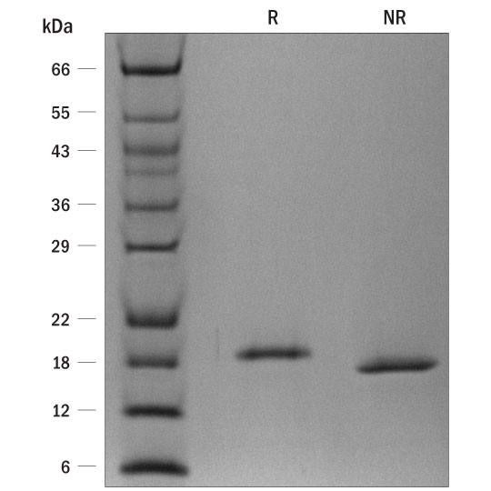 ProDots Recombinant Human LIF Protein SDS-PAGE