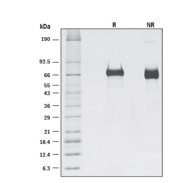 Recombinant Human LILRB2/CD85d/ILT4 His-tag Protein SDS-PAGE