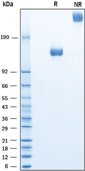 Recombinant Human LRIG2 Fc Chimera Protein SDS-PAGE
