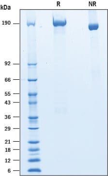 Recombinant Mouse LRP-4 His-tag Protein SDS-PAGE