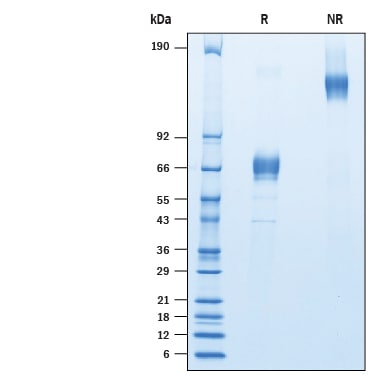 Recombinant Human LRRC52 Fc Chimera Protein SDS-PAGE