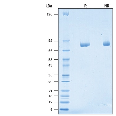 Recombinant Human LRRN2 His-tag SDS-PAGE