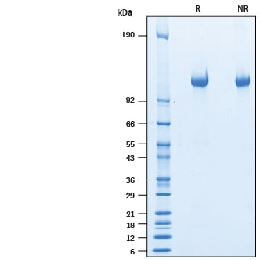 Recombinant Human LRRN4 His-tag Protein SDS-PAGE