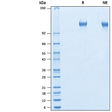 Recombinant Mouse LRRN4 His-tag Protein SDS-PAGE