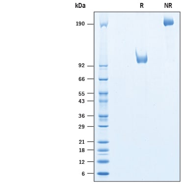 Recombinant Human LRRTM1 Fc Chimera Protein SDS-PAGE