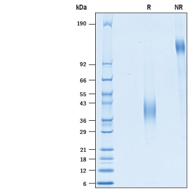 Recombinant Mouse LSECtin/CLEC4G Protein SDS-PAGE