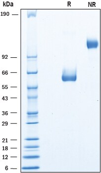 Recombinant Human LYPD6 Fc Chimera Protein SDS-PAGE