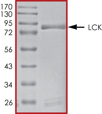 Recombinant Human Active Lck Protein SDS-PAGE