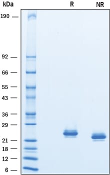 Recombinant Cynomolgus Lipocalin-2/NGAL His-tag Protein SDS-PAGE
