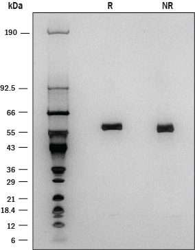 Recombinant Human Lipoprotein Lipase/LPL Protein SDS-PAGE