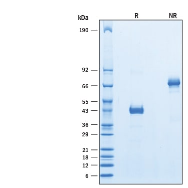 Recombinant Human Ly6D Fc Chimera Protein SDS-PAGE