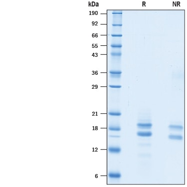 Recombinant Human Ly6H His-tag Protein SDS-PAGE