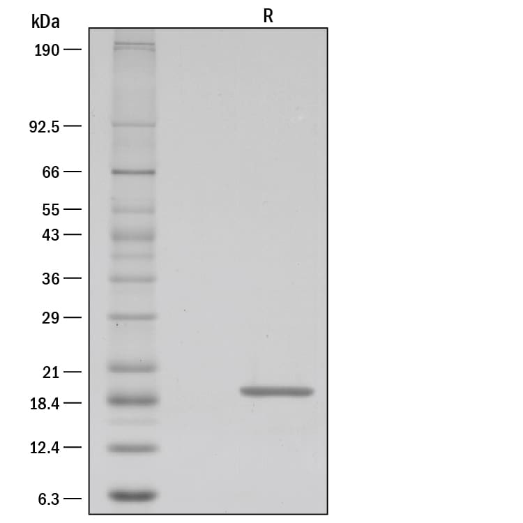 Recombinant Human Lymphotoxin-alpha/TNF-beta Protein SDS-PAGE