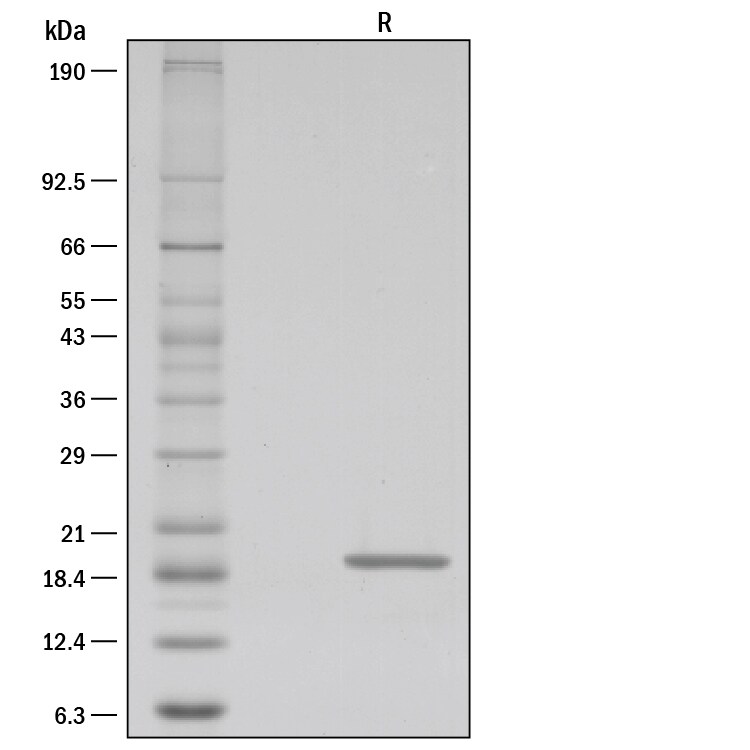 Recombinant Human Lymphotoxin-alpha/TNF-beta Protein SDS-PAGE
