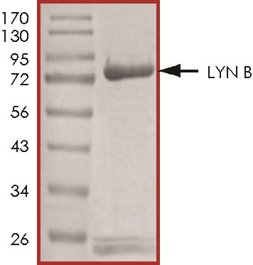 Recombinant Human Active Lyn B Protein SDS-PAGE
