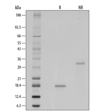 Recombinant Human M-CSF GMP Protein SDS-PAGE