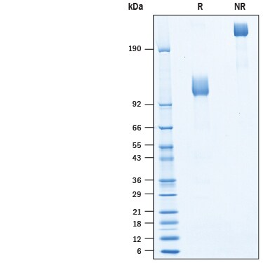 Recombinant Human M-CSF R/CD115 Fc Avi-tag Protein SDS-PAGE