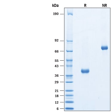 Recombinant Human MFAP4 Protein SDS-PAGE