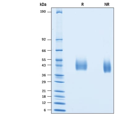 Recombinant Human MICB His-tag Protein SDS-PAGE