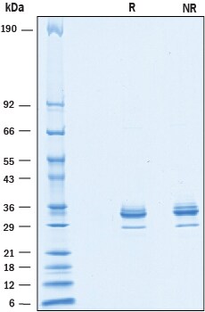 Recombinant Human Mesothelin (aa 35-289) His-tag Protein SDS-PAGE
