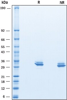 Recombinant Human Myocilin His-tag Protein SDS-PAGE