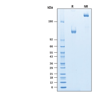 Recombinant Human NCAM-1/CD56 Fc Chimera Protein Binding Activity