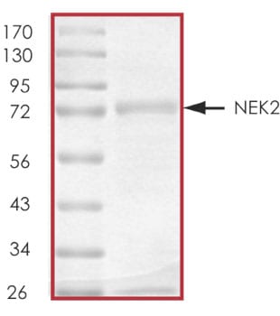Recombinant Human Active NEK2 Protein SDS-PAGE