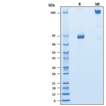 Recombinant Human NPRC/NPR3 Fc Chimera Protein SDS-PAGE