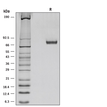 Recombinant Mouse Netrin-1 Protein SDS-PAGE
