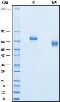 Recombinant Human Netrin-G1a His-tag Protein SDS-PAGE