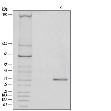 Recombinant Human NRG1-beta 1/HRG1-beta 1 ECD Protein SDS-PAGE