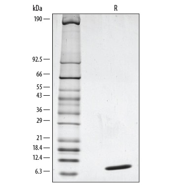 Recombinant Human NRG1-beta 1/HRG1-beta 1 EGF Domain Protein SDS-PAGE